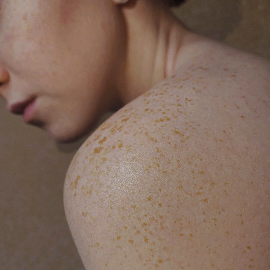 Proderma, dermatología, oncoquirúrgica, salud, Tampico