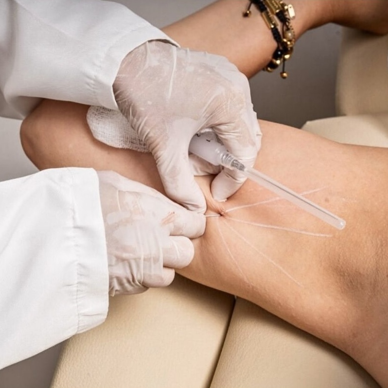 Bioestimulación, Corporal, ProDerma, Clínica, Dermatología, Estética.