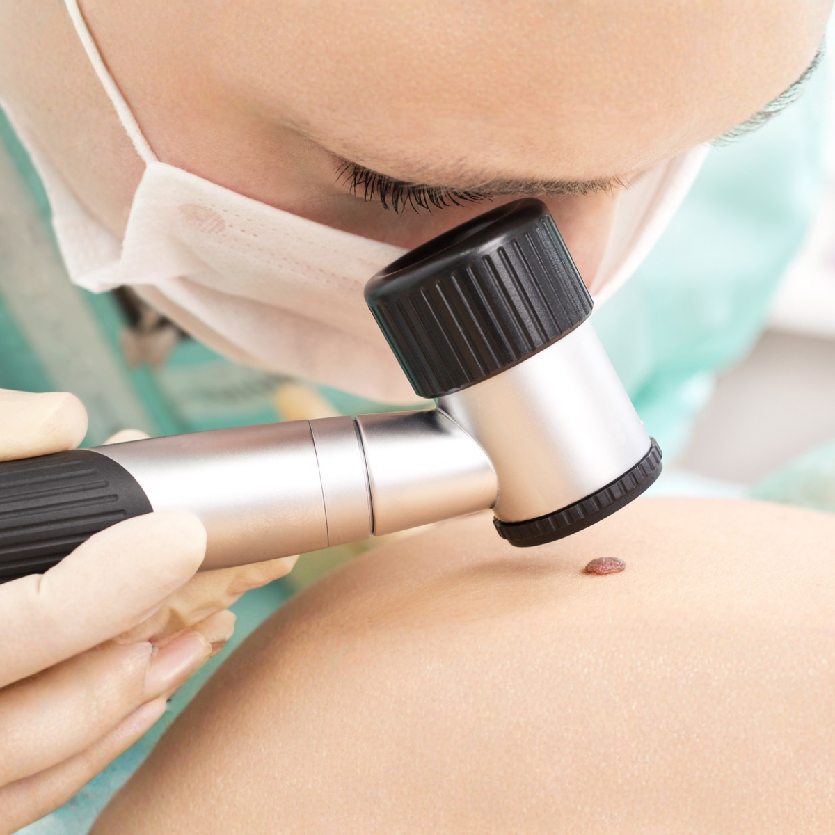 Proderma, dermatología,  Oncoquirúrgica,  dermatoscopía, clínica 