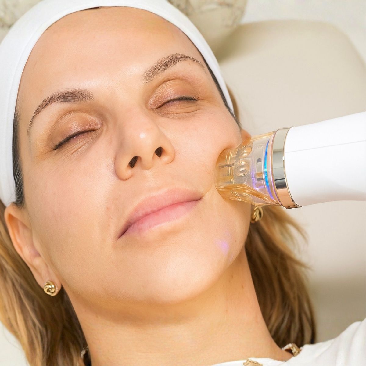 Proderma,  dermatología,  clínica,  colágeno, elastina